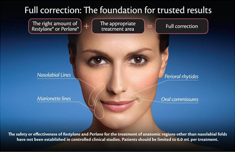 eliminate or reduce lines with Restylane in Chevy Chase, MD
