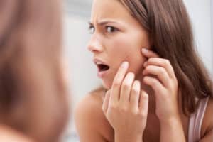 Acne Treatment Chevy Chase MD