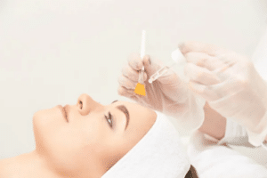 chemical peels