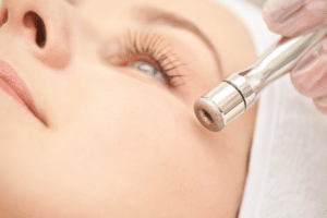 microdermabrasion 