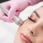 Sapphire Microdermabrasion Chevy Chase, M