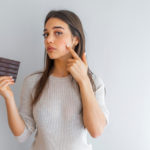 Young woman with problem skin holding chocolate bar