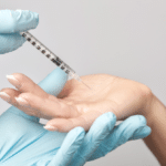 injections of botulinum toxin on the palms of a woman against hyperhidrosis.