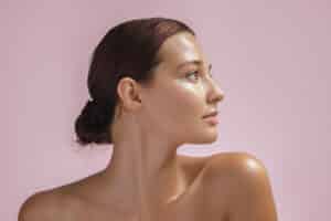 Woman with clear skin after chemical peel treatment